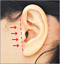 ノエル・カッティングライン