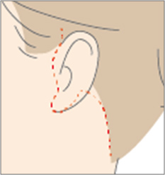 ノエル・カッティングライン