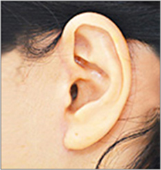 ノエル・カッティングライン